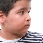 Childhood skin conditions & rashes