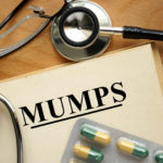 Mumps