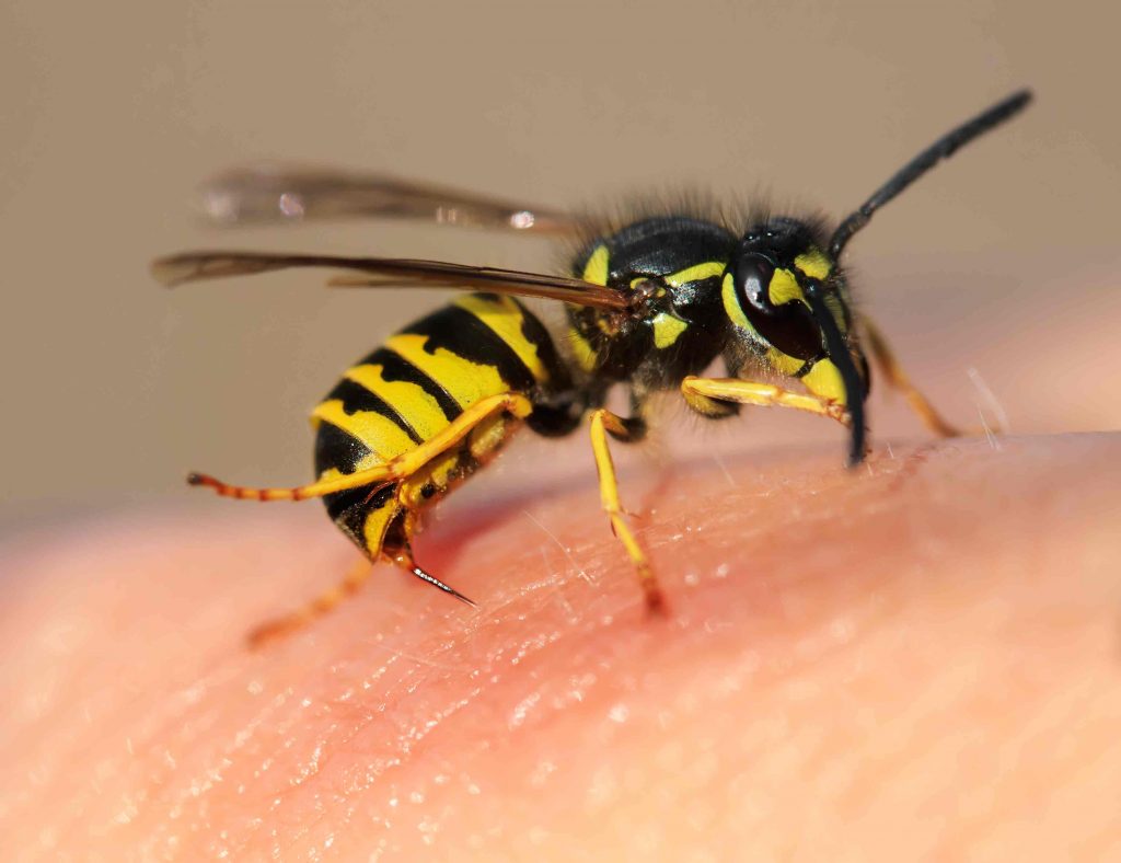 bug bites and stings